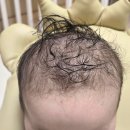 백세복지의료기기판매 | 아기 아토피 두피 각질·가려움, 제로이드MD루트힐 처방 후기