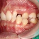 치아룸 치과기공소 이미지