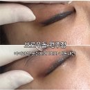 3136 | 아이라인 문신제거 1회차 내돈내산 후기 통증제로 잔흔제거 잘하는곳 : 브로우돌 원주점