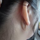 부천 중상동 유도짐 | 부천성형외과 블루로즈 실리프팅 통증 붓기 후기