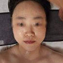 제이에스테틱((피부) | [과천피부관리] 제이에스테틱 과천점에서 피부관리 솔직후기