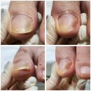 양덕동530 | [공지] 창원 문제성 손, 발톱 / 전문샵에서 관리받으세요!!