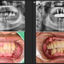 선사치과기공소 이미지