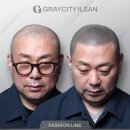 정수리 | 고양 정수리문신 후기, 흑채 사용을 멈춘 계기