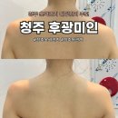 청주윤곽관리 후광미인 뱀부마사지 솔직후기