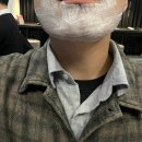 메티의원 | 강남 논현역 메티의원 남성 턱인중 레이저 제모 3회차 후기