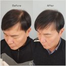분당-60 | 분당두피문신 도트라인제라에서 60대 환갑선물 후기