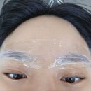 인하뷰티 | 인천 눈썹문신제거 미작뷰티 인천점 후기 :: 잔흔제거과정 고통정도 내돈내산 추천