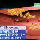 고지혈증 조절하는 식습관은? 이미지