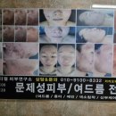 [경기/군포] 산본여드름관리 - 주미에스테틱