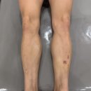 털복숭이친구들 | 진주왁싱 남자 다리털 정리후기 친구 따라갔다가 털복숭이탈출