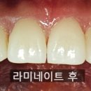 서현치과기공소 이미지