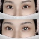 로로 속눈썹 | 대구 속눈썹펌 자연스럽고 유지력 좋은 바이 로로 후기