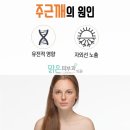 맑은피부과의원 네이버블로그