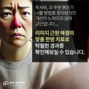 코 홍조와 주변 붉은기 확실하게 증상 가라앉힐 맞춤 한방치료 이미지