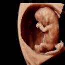 한마음산부인과의원 | [10주차] 선린자모의원 전원, 산후조리원 예약, 입체초음파