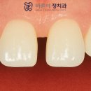 바이오치과 기공소 이미지