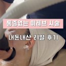 미 사랑피부관리 | 리블에스테틱 관리 후기 | 미레브(MIREV) 관리 받고 피부 달라진 리얼 후기 | 결혼 준비 피부관리 추천