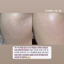 TM유통 | &lt;오픈&gt; 모공앰플 3차 오픈! (최대 할인, 2+1+1 이벤트★)