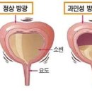 소변이 자주 마려워요 빈뇨 증상 및 원인남자여성 이미지