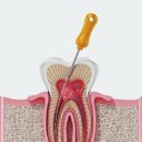 신사플란트치과병원 이미지