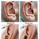 포낙보청기은평센터 이미지