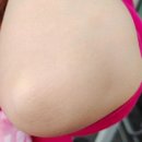 매일인터넷약국 | 유리아크림 약국 가격 얼굴 팔꿈치 각질관리 리얼 후기