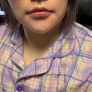 투머치큐트 | 신사역입술필러 입술비대칭 자연스럽게 받고 온 후기