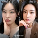 정석성형외과의원 이미지