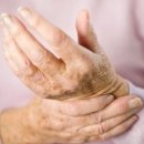 손목터널증후군의 증상 & 예방법 이미지