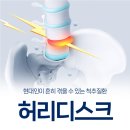 거제몽돌신경외과의원 | [허리디스크]와 치료 방법: 거제신경외과, 주사 치료 VS 신경차단술, 나에게 맞는 치료는?