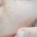 르네셀토지금고점 | 연예인 피부따라 잡기?? 르네셀 용현점에서 느껴보세요^^