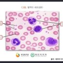 중대한재생불량성빈혈진단비보장 특별약관 (중대한재생불량성빈혈의 정의 및 진단확정) 이미지