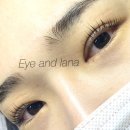 아이앤라나