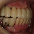 여치과기공소 이미지