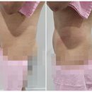 오앤리 스킨엔헤드스파 파주점 이미지