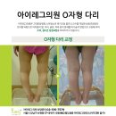 아이레그플러스의원 이미지