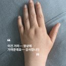 [공지] 림프순환 마사지, 환자가 깜짝 놀란 온콜로지에스테틱 림프부종 완화 효과