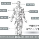 ﻿만병의 원인… 몸속 만성 염증 줄이는 방법 4 이미지