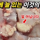 지금까지 알인줄 알고 먹었는데 이게 전부 기생충? 이미지