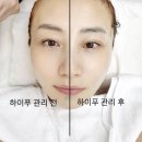 일산피부관리 추천 40대 하이푸 리프팅 관리 라페스타 에스테틱 스컬프티드스킨스튜디오 후기