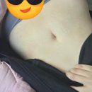 제생바이오 | 신촌 복부 지방추출주사 4달차 복부 현재상태