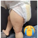 태소아청소년과의원 이미지