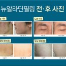 알라딘 스킨케어
