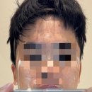시간관리효율화 | [수원/팔달구] 수원여드름피부과 추천 골드ppt 찐후기 2탄 :: 후한의원 수원
