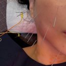 역삼한의원 | 역삼 안면비대칭 야간진료 한의원 가격 실비 가능 솔직 후기