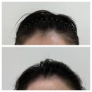 대구 정교한 SMP헤어라인 디뉴벨 뷰티 아카데미