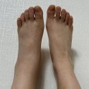 강수연 | [강일동 재활PT] 발목 인대 완전 파열 비수술후기, 이제 걸을 수 있을까?(1~3주차)