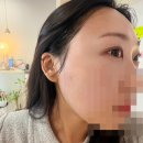 부천왁싱 주블리왁싱 주차 헤어라인 이마 구렛나루 대만족 후기 부천브라질리언왁싱샵