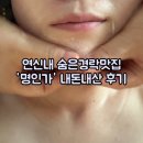 명인광고 | 연신내 예신웨딩관리 ‘명인가’ 내돈내산 후기(눈썹비대칭 캐치 최고ㅠ)